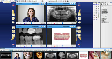 Henry Schein One launches Dentrix G7 in Canada
