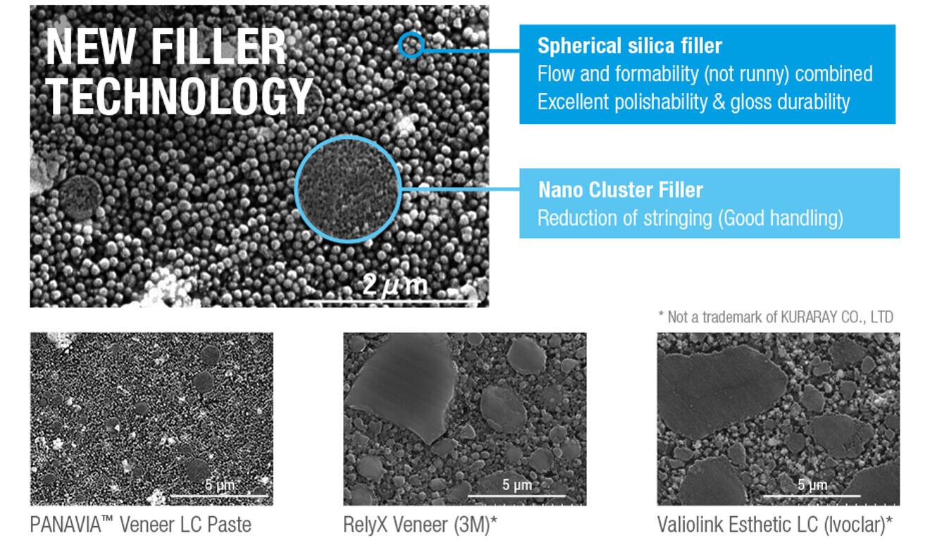Newly developed spherical silica fillers in PANAVIA Veneer LC allow for easy placement without drifting or sagging. (Image: Kuraray Noritake Dental)