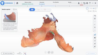 Labio y paladar fisurado Luna Video5