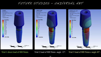 Analisi meccanica delle specifiche di tre diversi dispositivi di ritenzione protesica su impianti