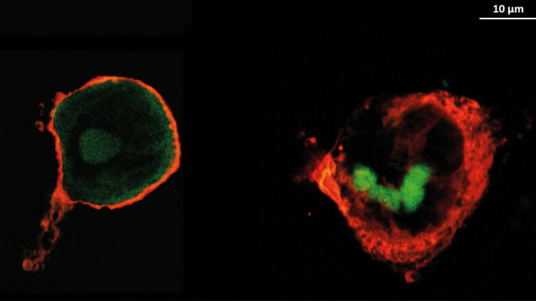 Neue Implantat-Beschichtungen zur Risikominimierung