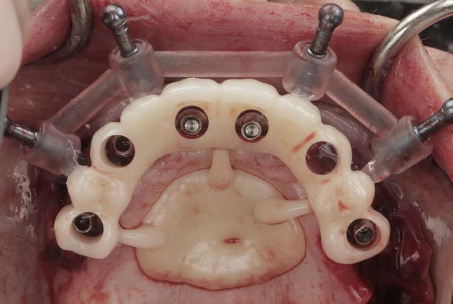 Fig. 13b: ... and in situ.