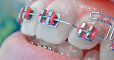 Smile for a Lifetime partners with America’s ToothFairy