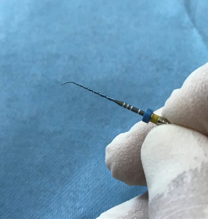 Fig. 4: A VDW.ROTATE 20.05 file pre-bent before insertion into the lingual canal.