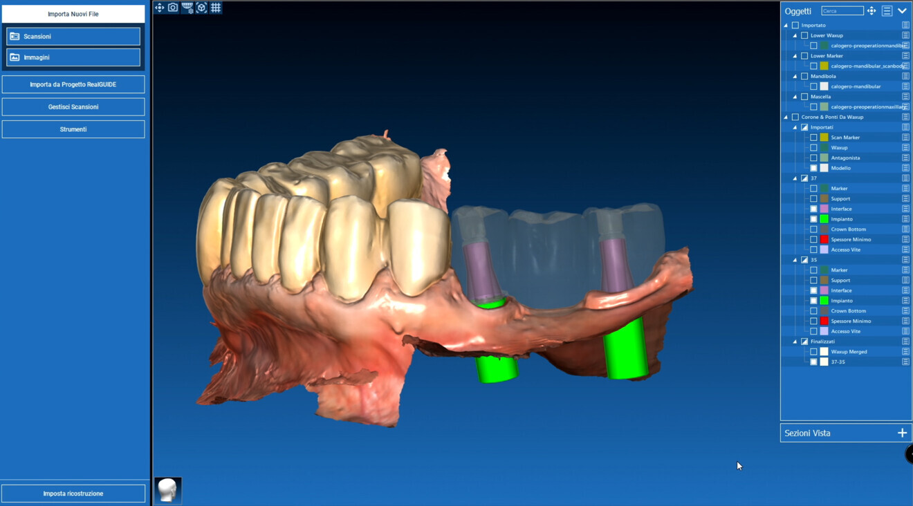 Figs. 14a–c:: Bridge design in RealGUIDE CAD+.