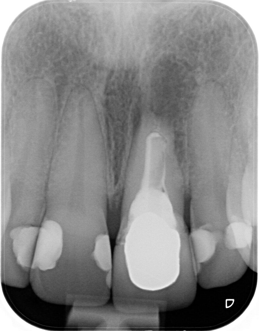  Fig. 2: Initial radiographic examination.