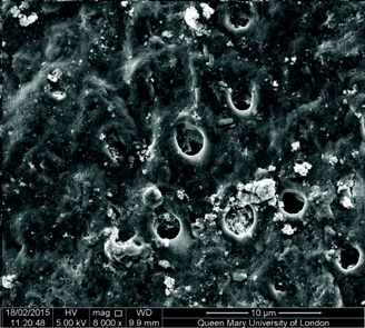 Fig. 10: Tubules remained occluded after acid challenge (research at Queen Mary University of London).