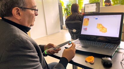 Lo que debes saber sobre los escáneres intraorales (1)