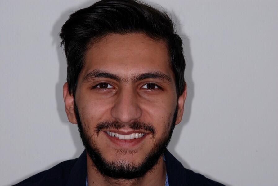 Fig. 24: Full-face frontal view after treatment.