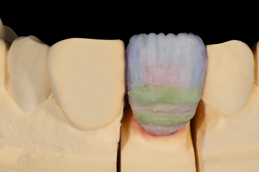 Fig. 7. Se añadió puntualmente EE1 (blanquecino translúcido) para integrar líneas blancas finas.