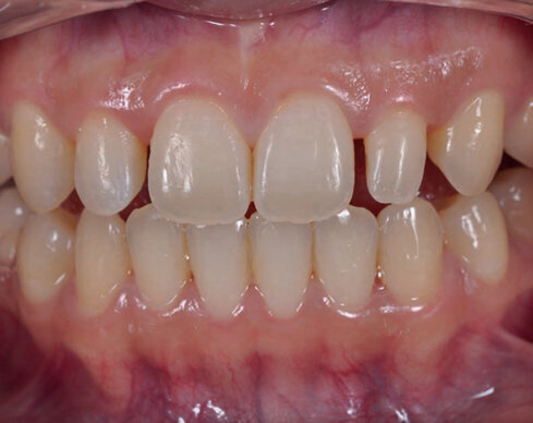 Počáteční situace