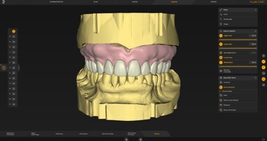 inLab 22.0: amplia la gamma di produzione; integra CEREC Primemill; snellisce i flussi di lavoro