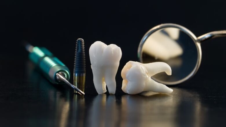 VGZ contracteert te weinig tandartsen-implantologen, vindt ANT