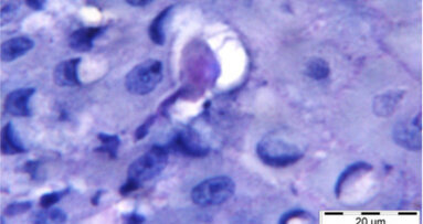 Parodontitis: Mundspezifische Amöbe entlarvt