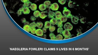 Naegleria fowleri claims 9 lives in 6 months