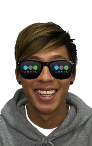 Fig. 23: Patient’s facial photograph after aligner treatment.