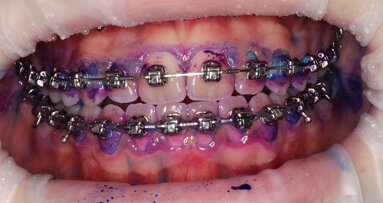 The orthodontic patient - From hell to heaven