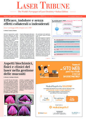Laser Tribune Italy No. 1, 2017