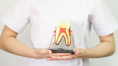 Wurzelkanalbehandlung oder doch ein Implantat?