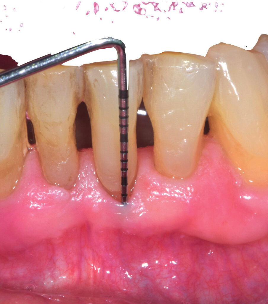 Fig. 8 - Guarigione a 3 settimane.