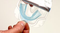 Estrategias estéticas en pacientes con ortodoncia