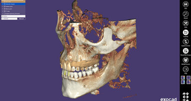 Exocad’s first international congress hailed a success