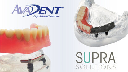 ALL-IN producent van 3D-kunstgebit