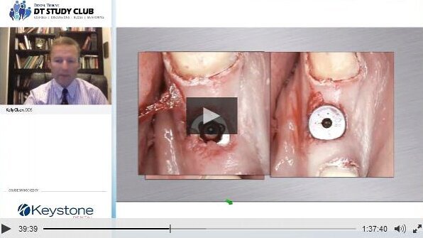 מחקר מגלה כי עבור אנשי מקצועות בריאות, לימוד בשידור טוב כמו אימון מסורתי