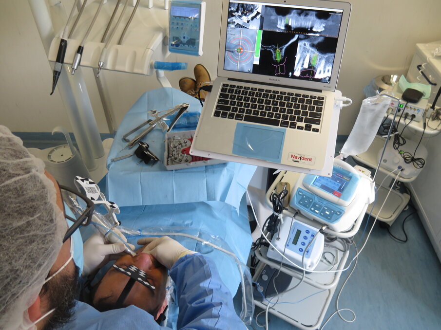 Fig. 12 - Ergonomia dell’ambiente di lavoro in chirurgia navigata. Per l’arcata 3 può essere richiesta la posizione ad ore 3 generalmente mai utilizzata in odontoiatria.