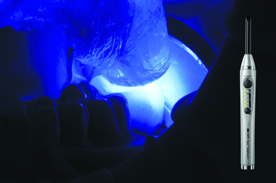 Fig. 12: Tack cure for 1-2 seconds.(!) Tip: Do not exceed recommended tack cure time, otherwise clean-up will be difficult. For a controlled time, use 3M™ Elipar™ S10 LED Curing Light or 3M™ Elipar™ DeepCure-S LED Curing Light tack curing function.