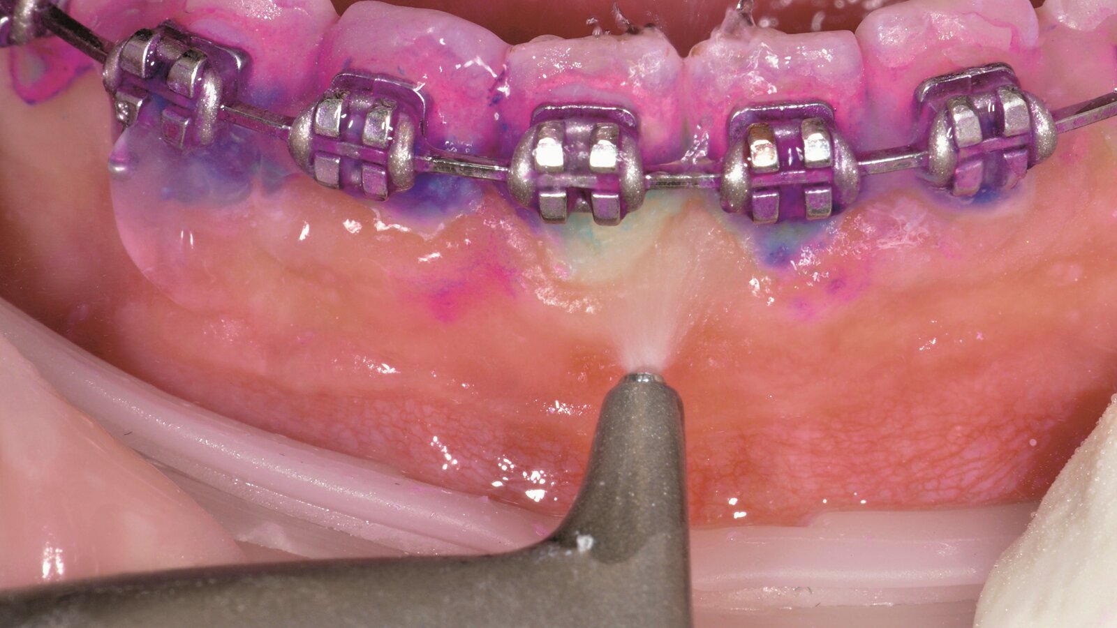 Ортодонтският пациент – от ада до рая