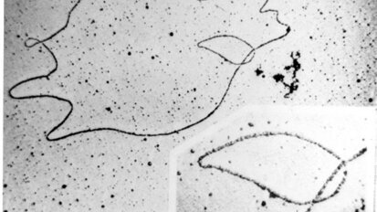 Chinezen ontdekken DNA-vaccin tegen cariës