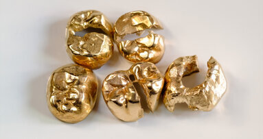 Zum Welttag des Sehens rufen Schweizer zu Zahngoldspenden für Augenoperationen auf