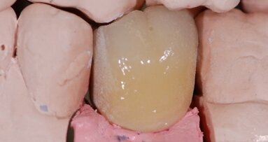 Algorytmy postępowania dla wykonywania indywidualnych rozwiązań protetycznych – część 1