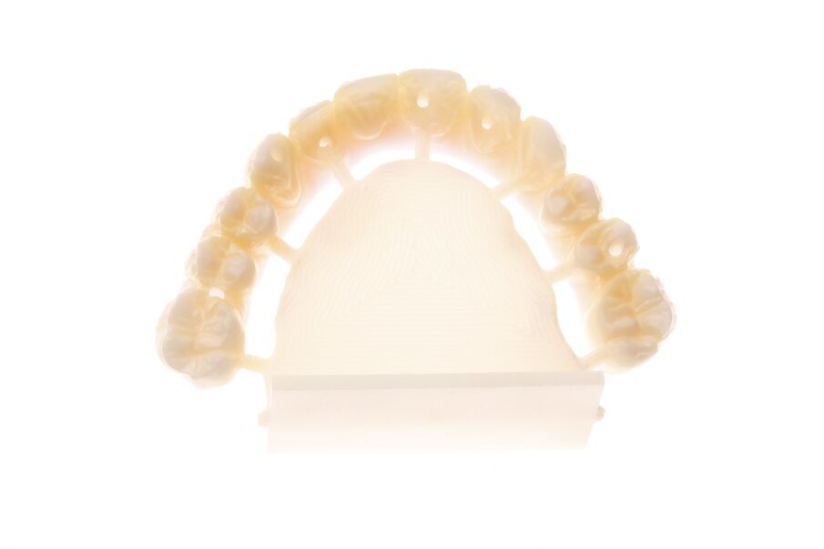 Fig. 5a: Choice of different definitive materials.