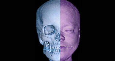 Pak Maxillofacial Surgeons Await International Recognition