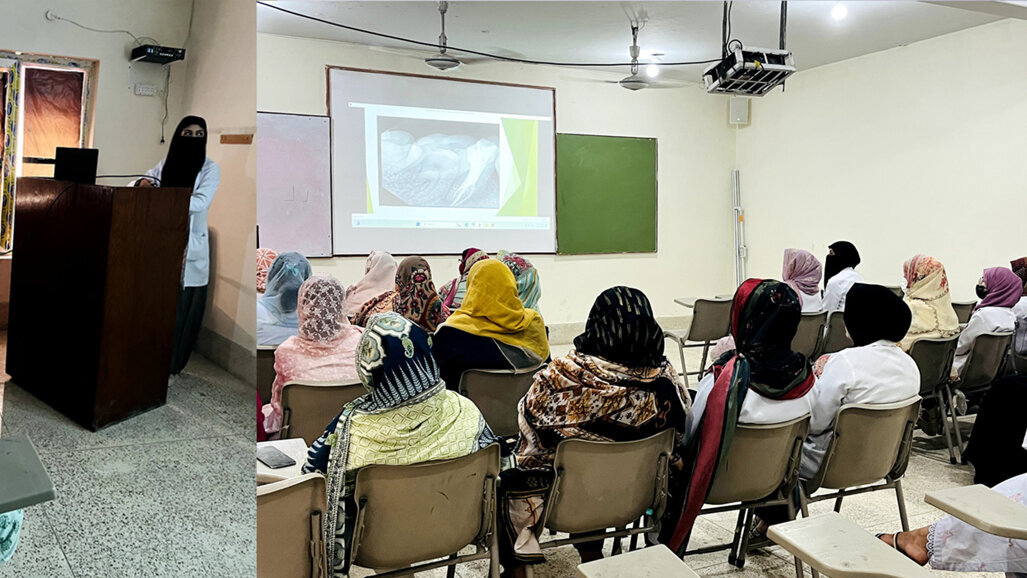 Rare 4-canal tooth case amazes at Bolan Dental College