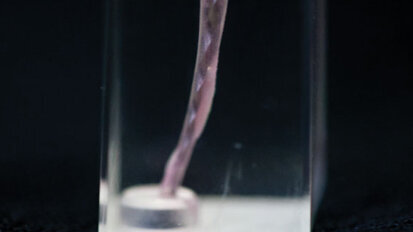 Passive micro-volume management of sodium hypochlorite in endodontic treatment Passive micro-volume management of sodium hypochlorite in endodontic treatment