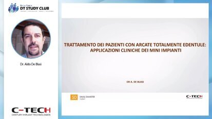 Trattamento dei pazienti con arcate totalmente edentule: applicazioni cliniche dei mini impianti