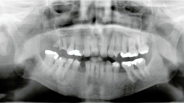 Met QuickSleeper bleef patiënt rustig