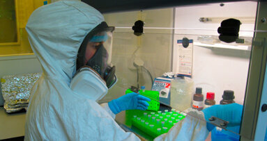 Forscher: Zahnstein ist Gedächtnis der Evolution