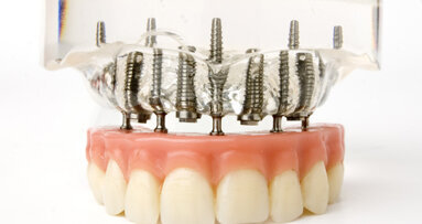 Vier implantaten volstaan voor klikgebit