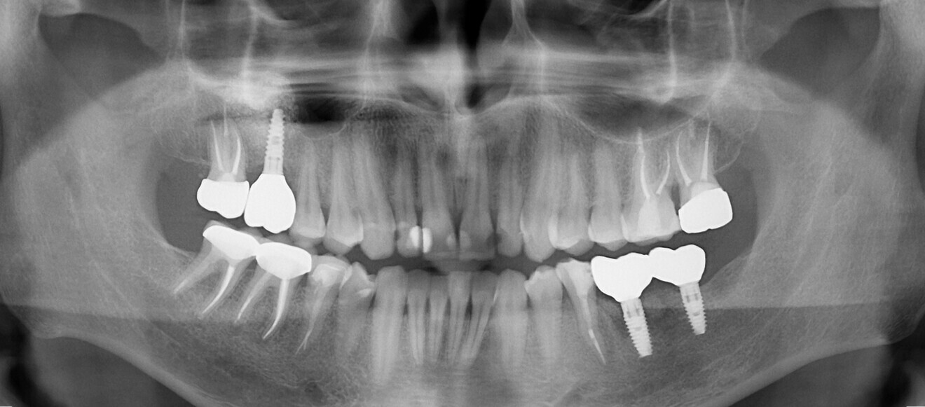Fig. 20 : Radiographies prises en 2017.