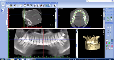 Para el mejor diagnóstico, utilice el mejor software