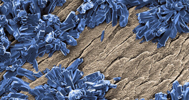 Blanchiment des dents : Les effets du peroxyde de carbamide sur les cellules dentaires