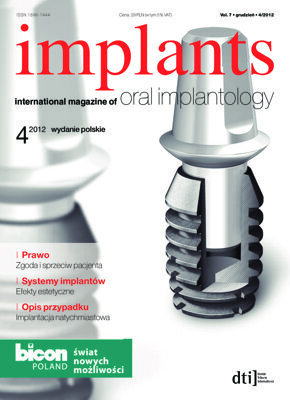 implants Poland No. 4, 2012 implants Poland No. 4, 2012