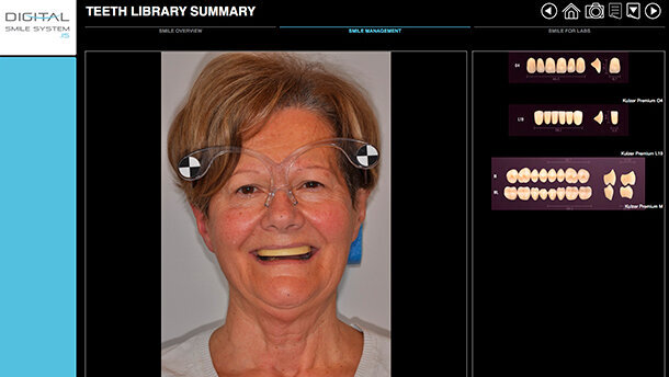 EGS ad IDS 2015: ecco le ultime novità CAD/CAM per il Digital Dentistry