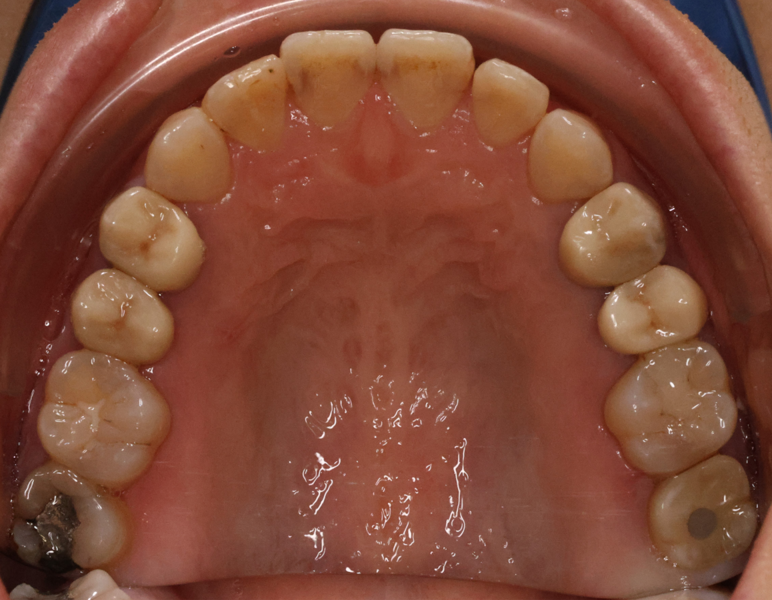 Fig. 9d