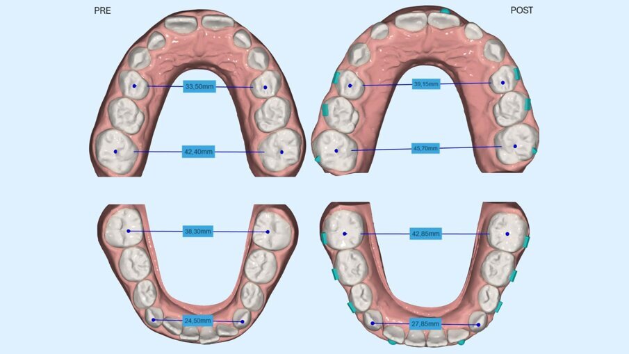 Fig. 4_Programmazione dei movimenti di ottimizzazione trasversale.