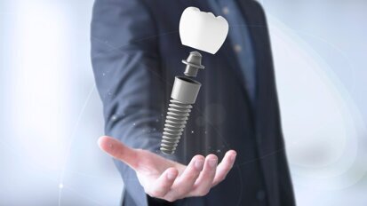 AI-powered AR systems will revolutionize implantology